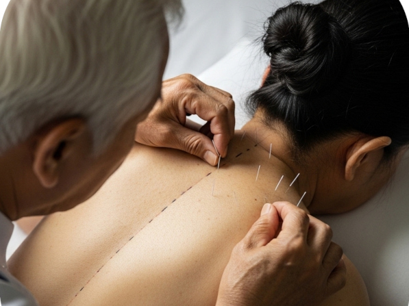 鍼灸